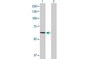 Western Blotting (WB) image for FGFR1 293T Cell Transient Overexpression Lysate(Denatured) (ABIN1331826)