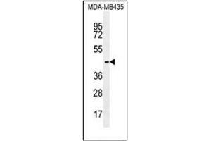 Western blot analysis of OR2L13 Antibody (C-term) in MDA-MB435 cell line lysates (35ug/lane). (OR2L13 Antikörper  (C-Term))