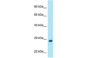 WB Suggested Anti-RAB4A Antibody Titration: 1.