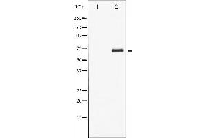 Western Blotting (WB) image for anti-LIM Domain Kinase 1 (LIMK1) (pThr508) antibody (ABIN6255701)