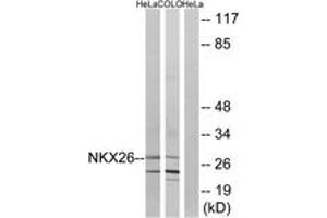 Western Blotting (WB) image for anti-NK2 Homeobox 6 (NKX2-6) (AA 91-140) antibody (ABIN2890383) (NKX2-6 Antikörper  (AA 91-140))