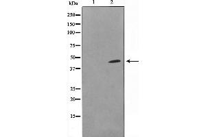 Western blot analysis on COLO205 cell lysate using DOK6 Antibody，The lane on the left is treated with the antigen-specific peptide.