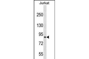 CUL4A Antibody (N-term) (ABIN657794 and ABIN2846767) western blot analysis in Jurkat cell line lysates (35 μg/lane).