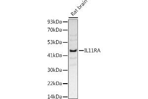Western blot analysis of extracts of Rat brain, using (ABIN7267984) at 1:1000 dilution. (IL11RA Antikörper)