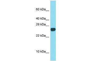 Western Blotting (WB) image for anti-Sperm Acrosome Associated Protein 3 (SPACA3) (C-Term) antibody (ABIN2790449)