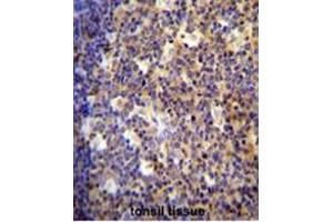 ALOX12B antibody (C-term) immunohistochemistry analysis in formalin fixed and paraffin embedded human tonsil tissue followed by peroxidase conjugation of the secondary antibody and DAB staining. (ALOX12B Antikörper  (C-Term))