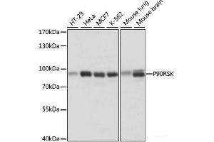 Western blot analysis of extracts of various cell lines using P90RSK Polyclonal Antibody at dilution of 1:1000. (RPS6KA3 Antikörper)
