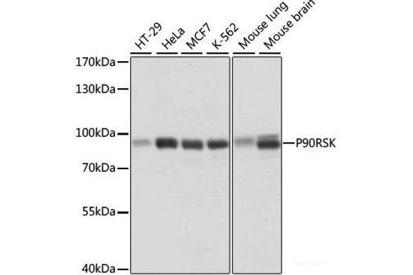 RPS6KA3 anticorps