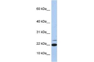 WB Suggested Anti-IL4 Antibody Titration: 0. (IL-4 Antikörper  (Middle Region))