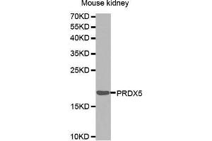 Western Blotting (WB) image for anti-Peroxiredoxin 5 (PRDX5) (AA 53-214) antibody (ABIN1682285) (Peroxiredoxin 5 Antikörper  (AA 53-214))