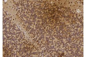 ABIN6274479 at 1/100 staining Rat brain tissue by IHC-P. (IP6K3 Antikörper  (Internal Region))
