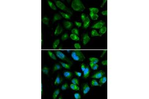 Immunofluorescence analysis of HepG2 cell using KIR2DL3 antibody. (KIR2DL3 Antikörper  (AA 22-245))