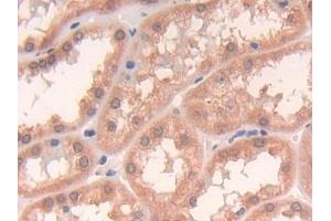 Immunohistochemistry (IHC) image for anti-P450 (Cytochrome) Oxidoreductase (POR) (AA 77-518) antibody (ABIN7435475)