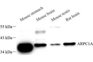 Western blot analysis of ARPC1A (ABIN7072894) at dilution of 1: 400
