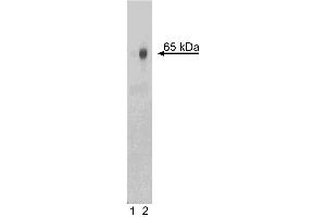 Western blot analysis of NF-kappaB p65 (pS529) in human peripheral blood mononuclear cells (PBMC). (NFkB Antikörper  (pSer529))
