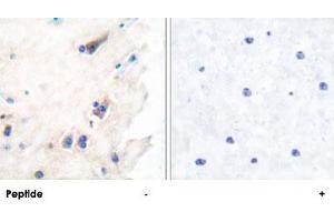 Immunohistochemical analysis of paraffin-embedded human brain tissue using PLCB3 polyclonal antibody . (PLCB3 Antikörper  (Ser1105))