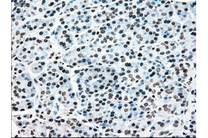 Immunohistochemical staining of paraffin-embedded colon tissue using anti-MAP2K4mouse monoclonal antibody. (MAP2K4 Antikörper)