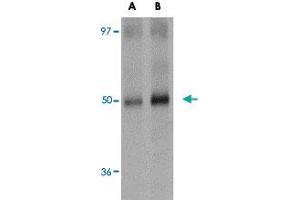 Western blot analysis of SQSTM1 in human spleen tissue lysate with SQSTM1 polyclonal antibody  at (A) 1 and (B) 2 ug/mL . (SQSTM1 Antikörper  (C-Term))