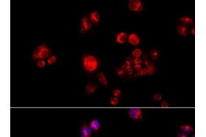 Immunofluorescence analysis of HeLa cells using GLUD2 Polyclonal Antibody at dilution of 1:100 (40x lens). (GLUD2 Antikörper)