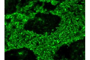 Image no. 1 for anti-Vimentin (VIM) antibody (ABIN335381) (Vimentin Antikörper)
