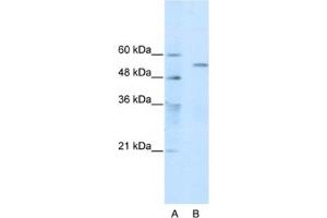 Western Blotting (WB) image for anti-Tripartite Motif Containing 35 (TRIM35) antibody (ABIN2461068) (TRIM35 Antikörper)