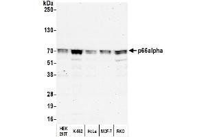 Western Blotting (WB) image for anti-GATA Zinc Finger Domain Containing 2A (GATAD2A) (AA 573-633) antibody (ABIN7454824) (GATAD2A Antikörper  (AA 573-633))