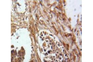 IHC-P analysis of Ovary tissue, with DAB staining. (Inhibin alpha Antikörper  (AA 25-363))