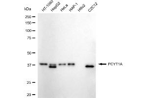 Western blotting analysis using PCYT1A antibody (ABIN7799789). (Rekombinanter PCYT1A Antikörper)