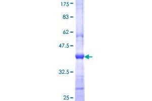 Inositol Polyphosphate-5-Phosphatase J (INPP5J) (AA 361-470) protein (GST tag)