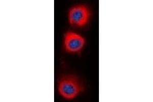 Immunofluorescent analysis of PPP2CA staining in HepG2 cells. (PPP2CA Antikörper  (C-Term))