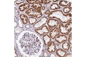 Immunohistochemical staining of human kidney with HISPPD1 polyclonal antibody  shows strong cytoplasmic positivity in cells in tubules while strong nuclear positivity in cells in glomeruli at 1:200-1:500 dilution. (HISPPD1 Antikörper)