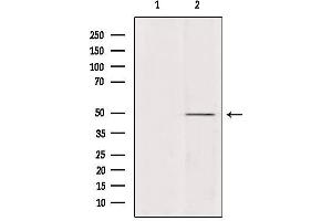 Western blot analysis of extracts from various samples, using ATP6V1C2 Antibody. (ATP6V1C2 Antikörper  (Internal Region))