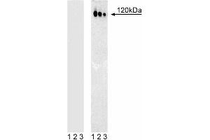 Western blot analysis of c-Cbl (pY774) in human T leukemia. (CBL Antikörper  (pTyr774))