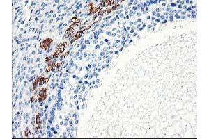 Immunohistochemistry (IHC) image for anti-ELK3, ETS-Domain Protein (SRF Accessory Protein 2) (ELK3) antibody (ABIN1498005) (ELK3 Antikörper)
