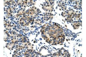 ZNF555 antibody was used for immunohistochemistry at a concentration of 4-8 ug/ml to stain Epithelial cells of pancreatic acinus (arrows) in Human Pancreas. (ZNF555 Antikörper  (N-Term))