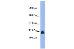 Western Blot showing Cst6 antibody used at a concentration of 1-2 ug/ml to detect its target protein. (CST6 Antikörper  (Middle Region))