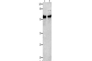 Western Blot analysis of Human liver cancer tissue and Hela cells using SMAD4 Polyclonal Antibody at dilution of 1:150 (SMAD4 Antikörper)