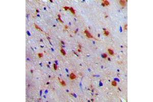 Immunohistochemical analysis of NEURL1 staining in human brain formalin fixed paraffin embedded tissue section. (NEURL Antikörper  (Center))