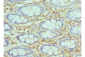Immunohistochemistry of paraffin-embedded human epityphlon tissue using ABIN7171057 at dilution of 1:100