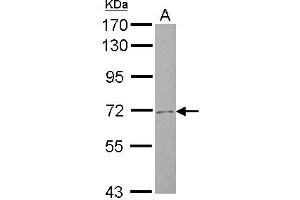 Western Blotting (WB) image for anti-Solute Carrier Family 4, Sodium Bicarbonate Cotransporter, Member 8 (SLC4A8) (N-Term) antibody (ABIN1494094) (SLC4A8 Antikörper  (N-Term))