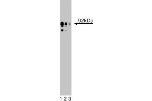 Western Blotting (WB) image for anti-Solute Carrier Family 9, Subfamily A (NHE1, Cation Proton Antiporter 1), Member 1 (SLC9A1) (AA 682-801) antibody (ABIN968659)