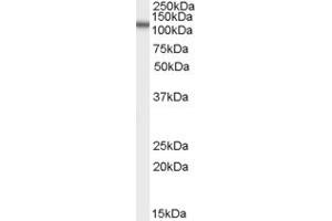 ABIN190918 (2µg/ml) staining of human spleen lysate (35µg protein in RIPA buffer). (OSBPL5 Antikörper  (N-Term))