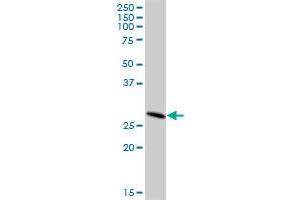 DHRS4L2 MaxPab polyclonal antibody. (DHRS4L2 Antikörper  (AA 1-230))