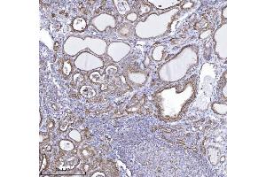 IHC analysis of DBN1 using anti-DBN1 antibody (ABIN7602637).