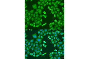 Immunofluorescence analysis of U2OS cells using CYP11B1 antibody (ABIN6292452) at dilution of 1:100. (CYP11B1 Antikörper)
