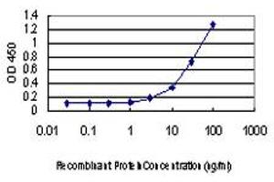 Detection limit for recombinant GST tagged PIM1 is approximately 0. (PIM1 Antikörper  (AA 1-313))