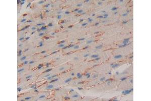Used in DAB staining on fromalin fixed paraffin- embedded heart tissue (GABBR1 Antikörper  (AA 199-570))