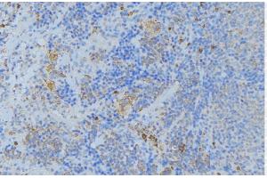 ABIN6277009 at 1/100 staining Human lymph node tissue by IHC-P. (Periostin Antikörper  (N-Term))