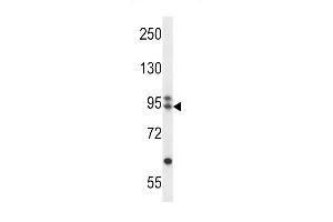 ARMC9 Antibody (N-term) (ABIN657366 and ABIN2846413) western blot analysis in CEM cell line lysates (35 μg/lane). (ARMC9 Antikörper  (N-Term))