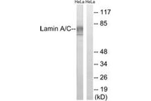 Western blot analysis of extracts from HeLa cells, treated with paclitaxel 1uM 24h, using Lamin A (Ab-22) Antibody. (Lamin A/C Antikörper  (AA 2-51))